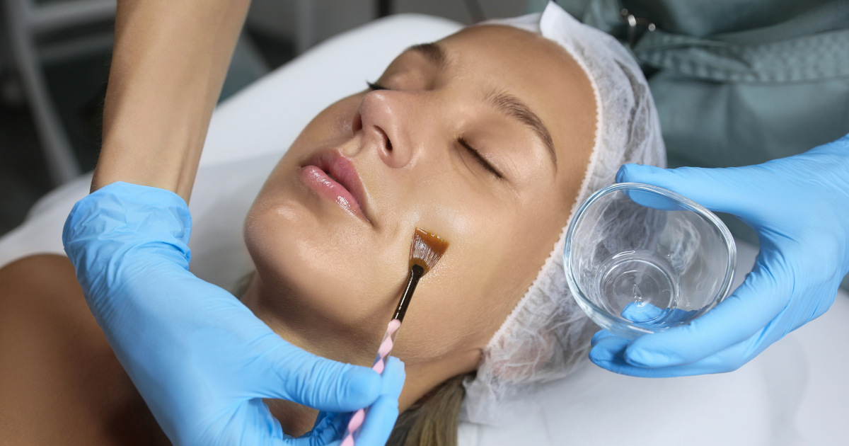 image of a woman getting a chemical peel