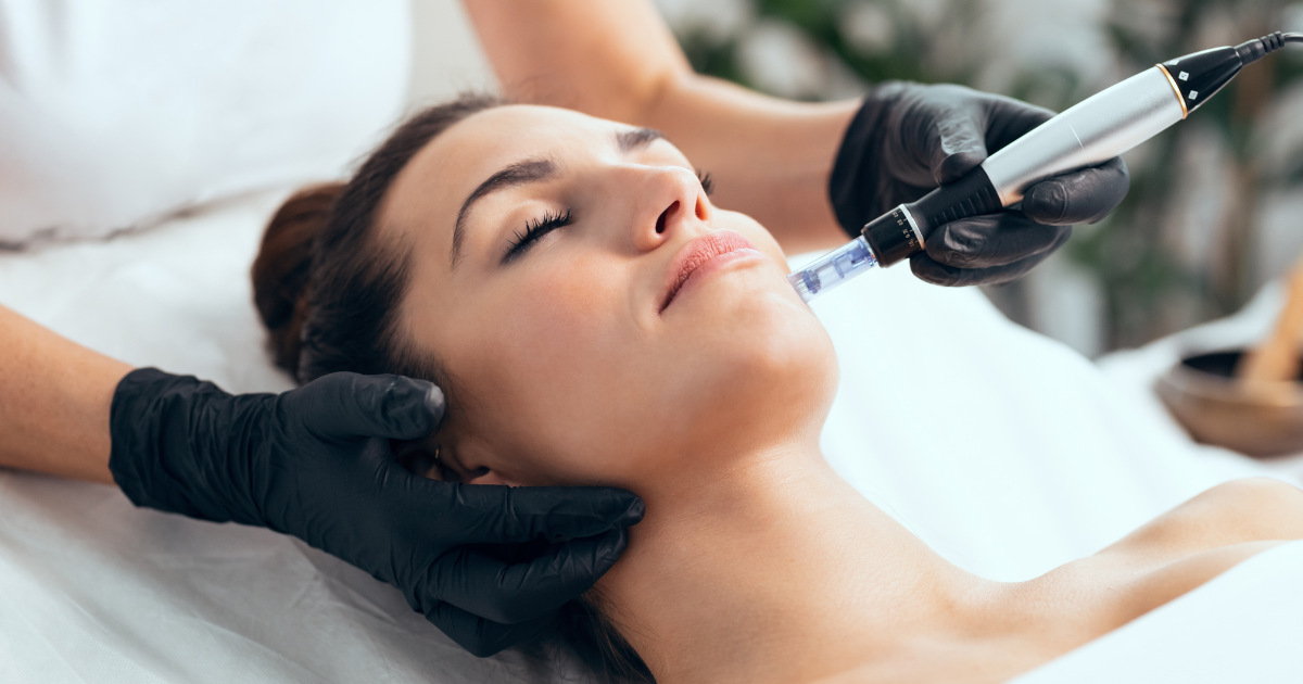 image of a woman getting microneedling done on their face